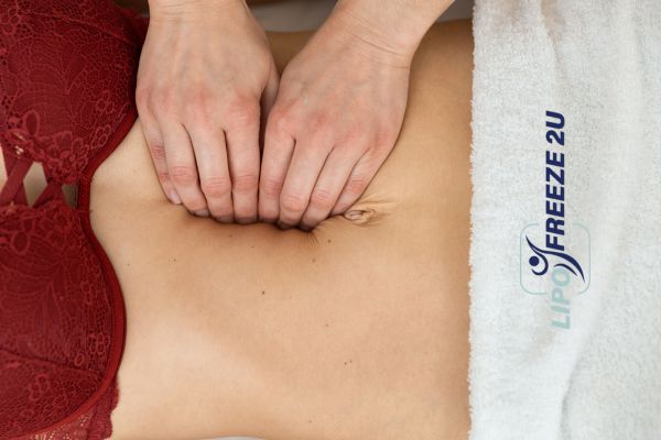 diastasis recti treatment Berkhamsted