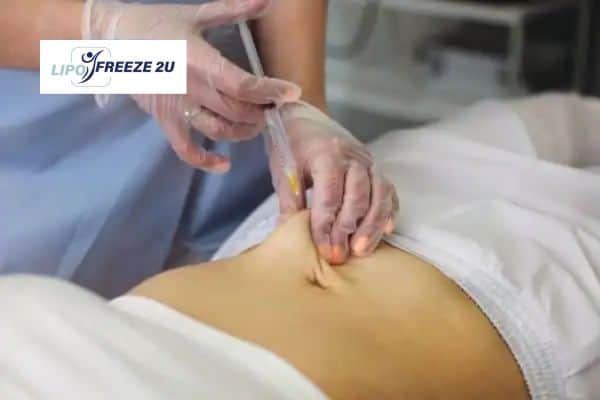 How Does Aqualyx Fat Dissolving Injection Work to Break Down Fat Berkhamsted?