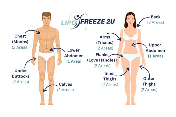 Areas you can have fat freezing treatment Berkhamsted