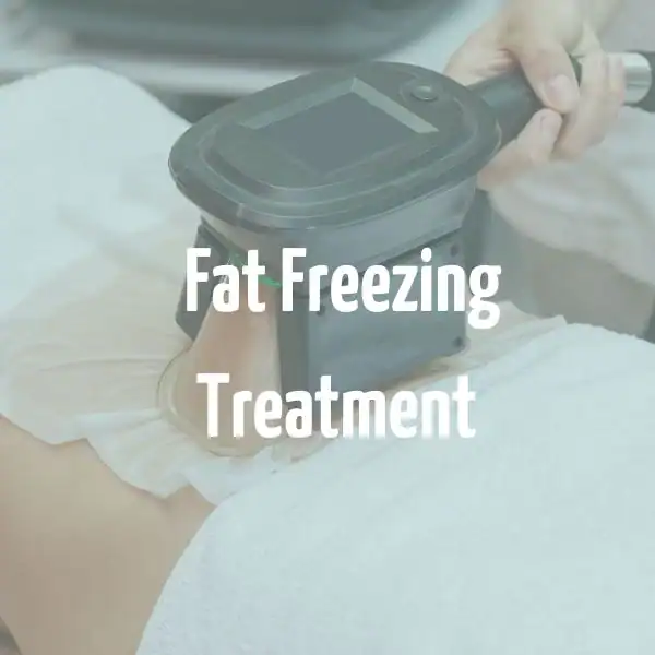 fat freezing treatment Berkhamsted