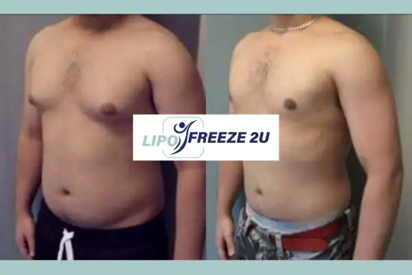 How Long Does It Take to See Results Berkhamsted?