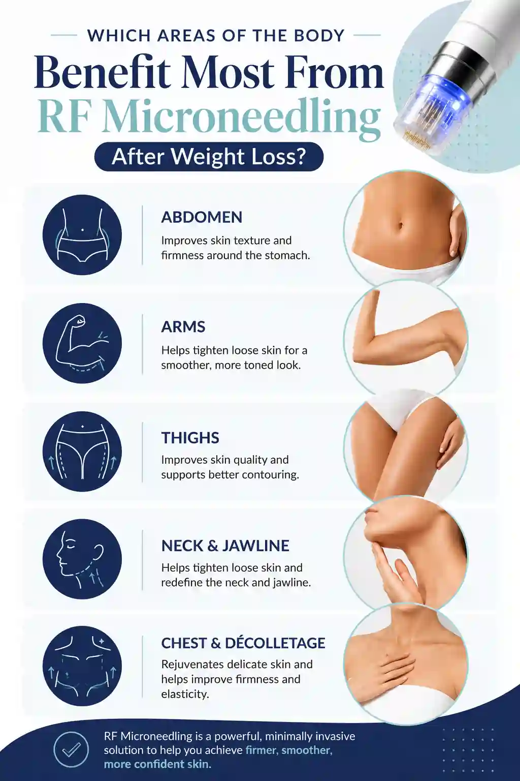 Which Areas of the Body Benefit Most From RF Microneedling After Weight Loss Berkhamsted